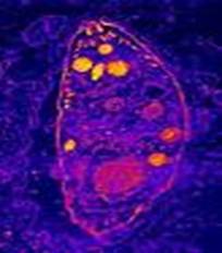 toxoplasma gondii