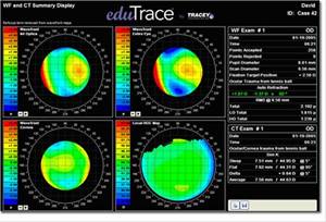 cirugia refractiva