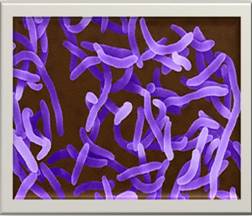 bacterias causantes de conjuntivitis